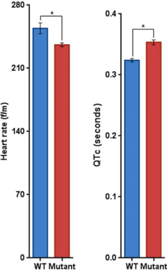 Figure 3. The EKG of MECP2 Mutant and WT Monkeys