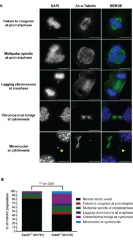 Figure 6. Mitotic and cytokinesis defects induced by loss of Setd2