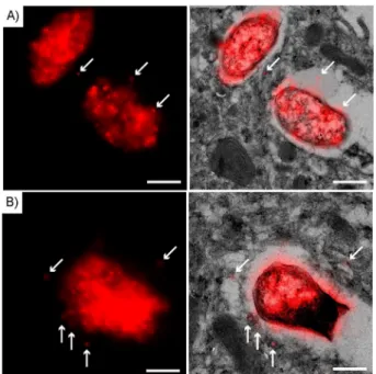 Figure 3. Super-resolution N-STORM-CLEM image of a 75 nm cryosection of BM-DCs incubated with Hpg–S