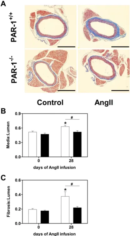 Figure 2. PAR-1 deficiency attenuates Ang II-induced remodeling of aorta
