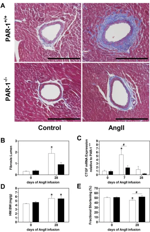 Figure 4. PAR-1 deficient mice are protected against Ang II-induced cardiac fibrosis and heart  dysfunction
