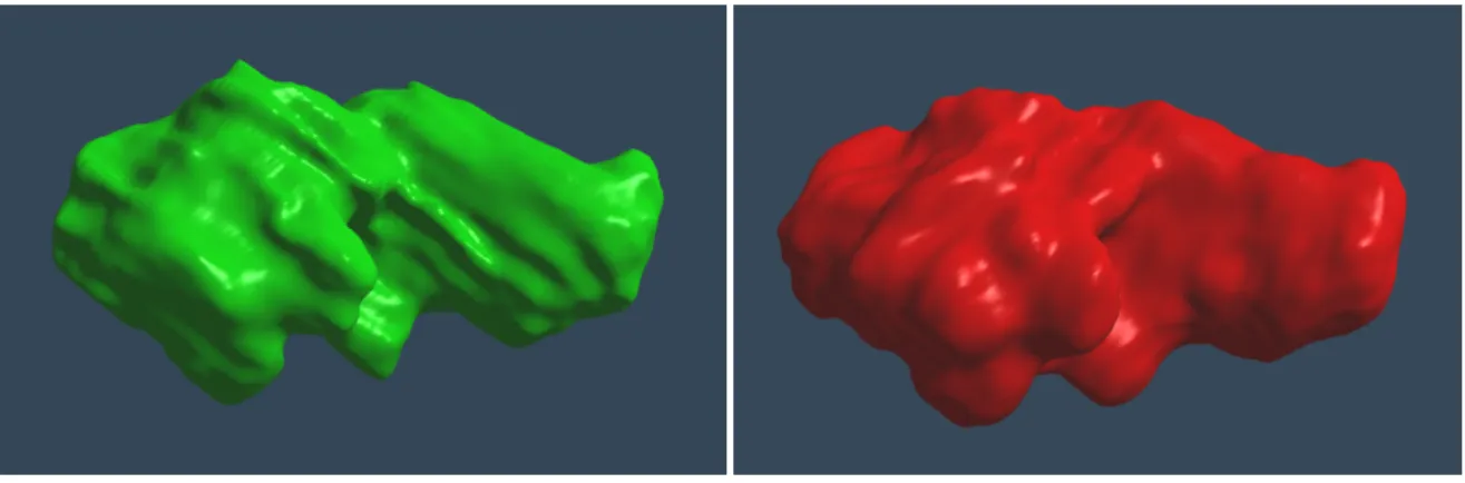 Figure 2.1: On the left, a tumor segmented from MRI data by hand. On the right, the same tumor segmented from the same MRI data by automatic algorithm.