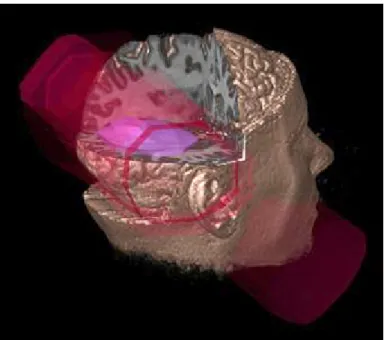 Figure 2.2: An example of an image from a 3D radiation treatment planning system [LFP + 90]