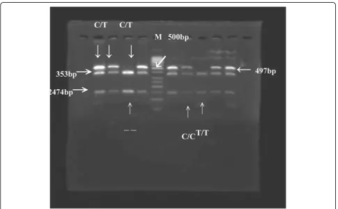 Figure 3 The DNA polymorphism of CD14 at position -159 digested with restriction enzyme AvaII