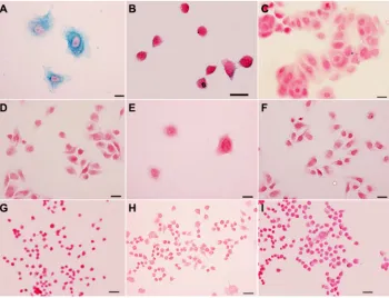 Figure 2 Prussian blue staining of her2-positive sK-Br-3 cancer cells (A), 100 times free pre-her2 blocked sK-Br-3 cancer cells (B), negative McF-7 and MDa-MB-231 cancer cells (C and D) treated with anti-her2-IONPs, and both sK-Br-3 and MDa-MB-231 treated 