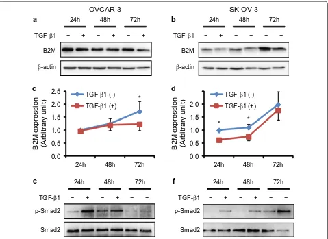 Fig. 5 Measurement of B2M concentration after TGF-β1 treatment. The concentration of B2M in the cytosol and culture medium of OVCAR-3 and SK-OV-3 cells in the absence (−) or presence (+) of 10 ng/ml TGF-β1 for 72 h (a) and 24 and 48 h (b), respectively, wa