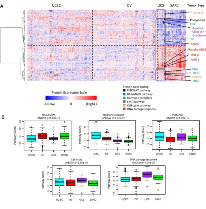 Figure 7. RPPA analysis demonstrating shared epithelial and mesenchymal features of UCS  tumors
