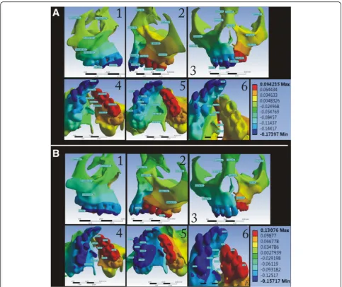 Fig. 5 Displacement pattern in the X-axis for the a conventional HYRAX expander and b bone-borne HYRAX expander (a1, b1, non-cleft side; a2,b2, cleft side; a3, b3, frontal view; a4, b4, left palatal slope; a5, b5, right palatal slope; and a6, b6, mid-palatal area)