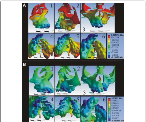 Fig. 6 Displacement pattern in the Y-axis for the a conventional HYRAX expander and b bone-borne HYRAX expander (a1, b1, non-cleft side; a2,b2, cleft side; a3, b3, frontal view; a4, b4, left palatal slope; a5, b5, right palatal slope; and a6, b6, mid-palatal area)