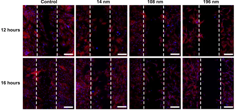 Figure 5 Wound healing in mesenchymal stem cells incubated without (control) or with different TiO2 particles (0.10 mg/mL) shown by confocal laser scanning microscopy.Notes: Scale bar = 100 µm