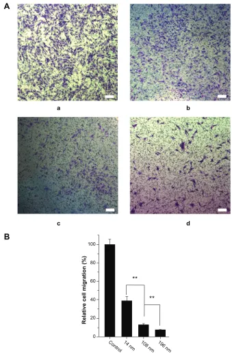 Figure 6 Characterization of cell migration. (A) Qualitative cell migration assay shown by Transwell assay after culture for 8 hours