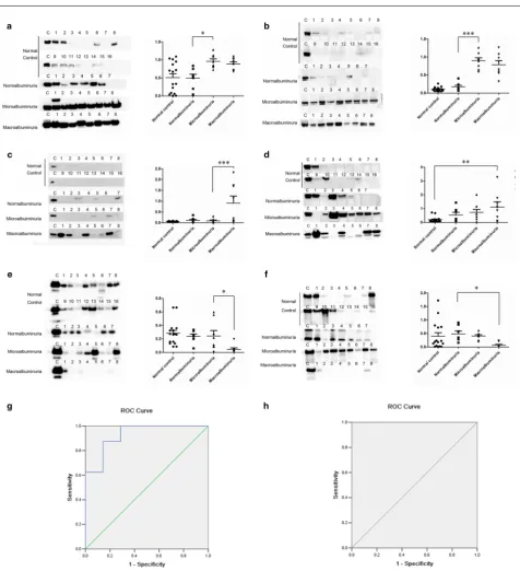Fig. 7 Western blot validation for six differential proteins. SERPINA1 (a), CP (b), TTR (c), APOA4 (d), EGF (e) and GCDFP15 (f)