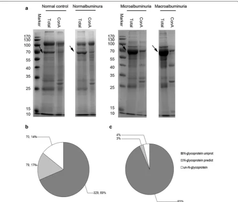 Table 2 Number of up-regulated proteins and down-regu-lated proteins in different stage of DN analyzed by LC–MS/MS
