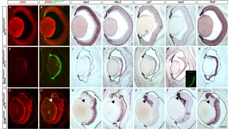 Figure 2-6 WNT signaling is expanded in Sox2-mutant eyes at E16.5. (A,B,H,I,O,P) IHC for SOX2 (red) and αP0 CREiresGFP reporter expression (green)  in  horizontal  sections  of  control  (αP0 CREiresGFP/+