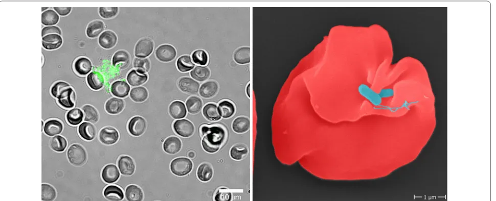 Fig. 7 Human erythrocytes infected with B. bacilliformis. Left: Fluorescence microscopy of human erythrocytes infected with GFP‑expressing B