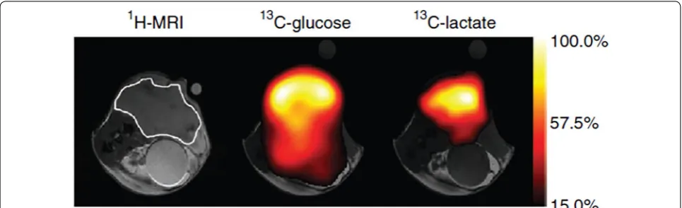 Fig. 1 Anatomical image is showing a subcutaneous EL4 tumor in a mouse model. Chemical-shift imaging for same animal was obtained 15 s after intravenous injection of 0.4 mL of 200 mM hyperpolarized glucose