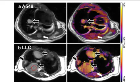 Fig. 6 APT imaging of lung tumors. Anatomical proton weighted image and APT-weighted images of A549 (a) and LLC (b) tumors in mouse model