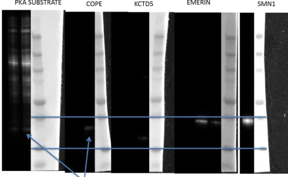 Figure 2.11: Top) Western blot of  IP’d phospho-proteins of interest identified by  MS shows that COPE is phosphorylated by OPKA after light stimulation and has  the same electrophoretic mobility shift as the unknown phospho-protein of interest