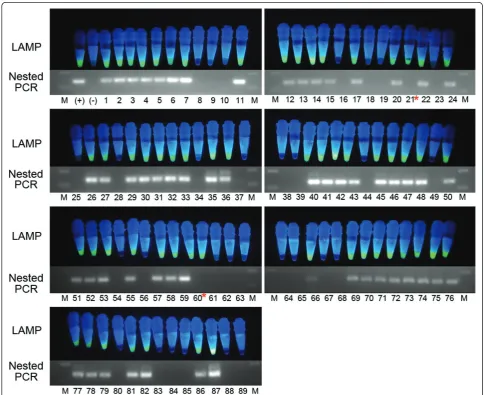 Table 1 Results of malaria detection by visualized LAMP,nested PCR, and microscopy
