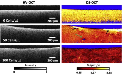 FIGURE 5 DS-OCT imaging of 3D cultures seeded with varying densities of RMF reveal  nano-scale pore-size changes in ECM due to remodeling.