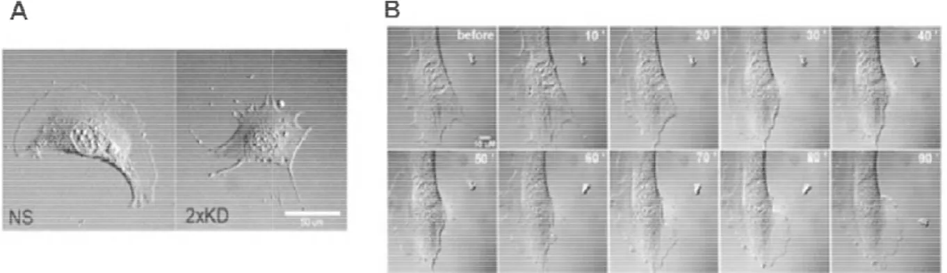 Figure  5  Cell  morphology  is  changed  upon  Arp2/3 rescued by microinjection of Arp2/3 complex