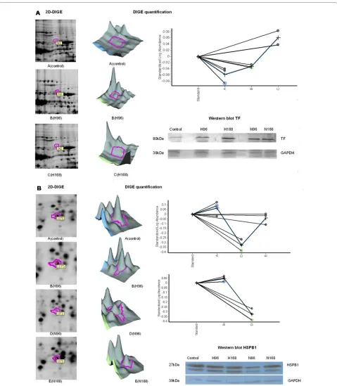 Figure 4 Expression analyses of selected proteins using DeCyder software and western blot validationquantification, and western blot confirmation of TF in H-PRRSV infected pigs