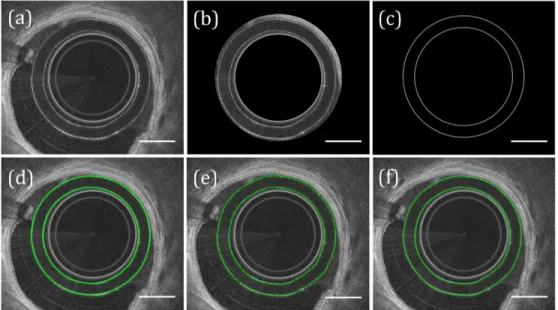 Fig. 2. Segmentation of catheter sheath. (a) Input image. (b) Approximate location of sheath  segmented based on known sheath dimensions