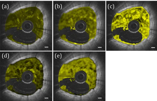 Fig. 5. Mucus GLCM statistics comparison. (a) Intensity image with mucus color coded in  yellow