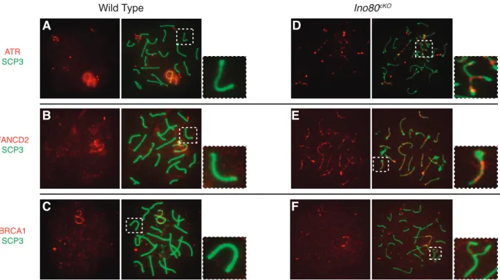 FIG. 6. FA-BRCA1 repair pathway factors localize to chromosomal axes. Distribution of factors from the FA-BRCA1 DNA repair pathway in pachytene- pachytene-stage wild-type (A–C) and Ino80 cKO (D–F) spermatocytes
