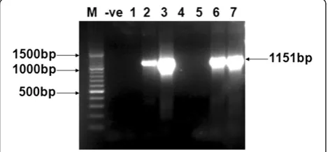 Figure 2 Confirmation of expression vector via restrictiondigestion. Restriction digestion of pCR2.1/E2 vector, sample #1-10are digested (gene of 1151 bp) and undigested plasmid respectively.1 Kb DNA Size Marker (M1) and λ/HindIII DNA size Marker (M2)are shown.