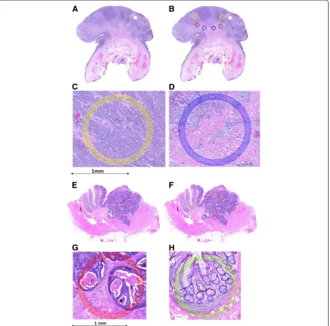 Figure 1 Two examples showing scanned H&E sections, followed by annotations of specific histological regions and high-powermagnifications of two different annotated regions