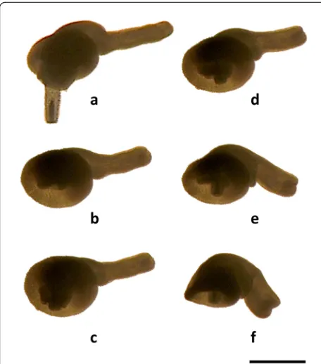 Fig. 8 Sequence of hindtrunk downward movement in a femalecystacanth of Corynosoma cetaceum