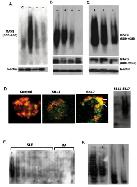 Figure 1. MAVS aggregation in SLE patients