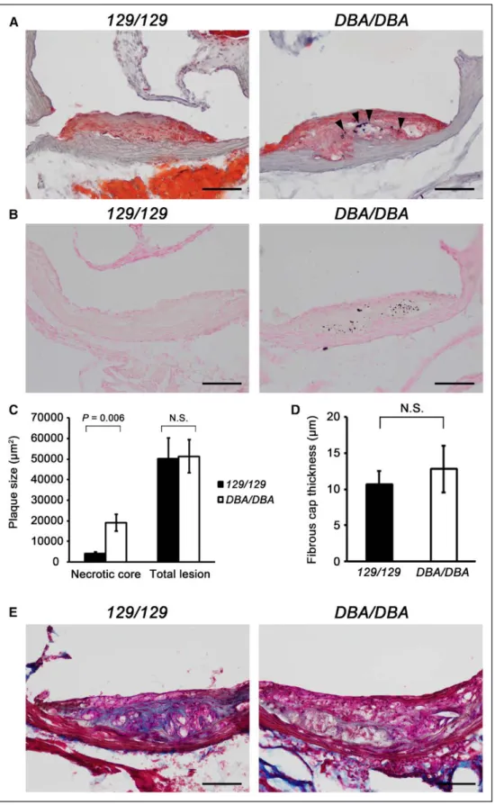 Figure 2. Aath4a DBA/DBA  mice develop plaques with increased calcium deposits, larger necrotic core, and less collagen content