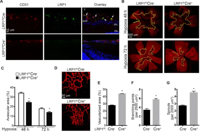 Figure 1. Intraretinal neovascularization increases in retinal endothelium lacking LRP1 during  hypoxia