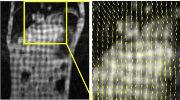 Figure 2.2: Tagged MR images with estimated motion fields (yellow box). This image and caption is from Chun et al