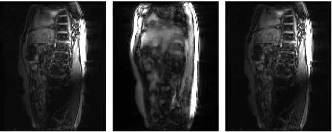 Figure 3.1: a slice from the simulated, warped 3D image (Left), the 2D projection derived from it as the input to CLARET (Center), and the corresponding slice from the estimated 3D warped image, the output of CLARET (Right).