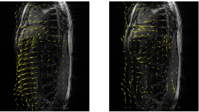 Figure 3.4: Actual acquired 2D projection image (left) the estimated image warped from the reference 3D image and projected to 2D (center) and the estimated image warped incorrectly with  magnitude-only images (right)