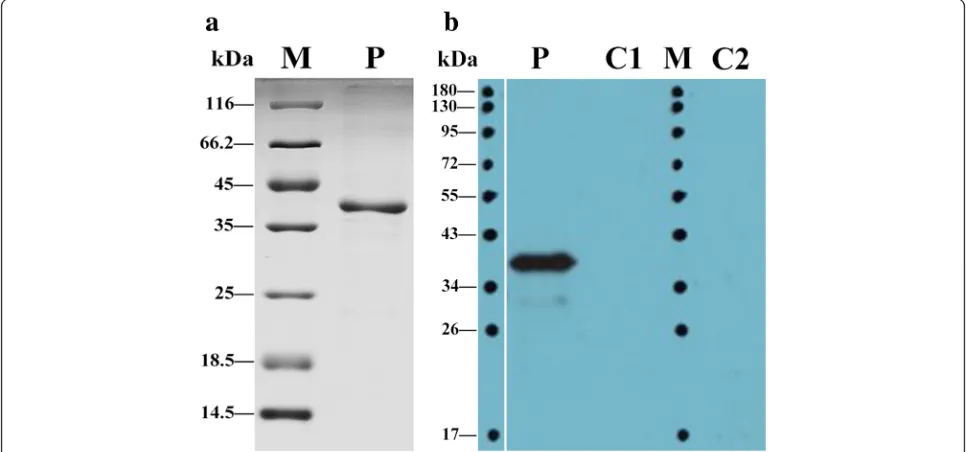 Fig. 1 SDS-PAGE and Western blot analyses of the purified rFgRab10 protein from the sonicated culture sediment offromsupernatant ofgiganticawas visualized using chemiluminescent HRP substrate and X-ray film