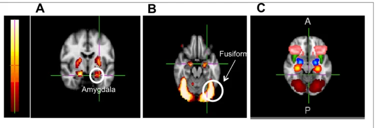 Figure 2 Full brain group activation maps depicting brain regions activated by the [Face>Object] condition