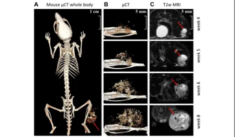 Figure 1 Representative MRI and μCT images of mouse xenografts 4 to 8 weeks after intratibial transplantation of patient-derived human OStissue showing tibial tumor mass