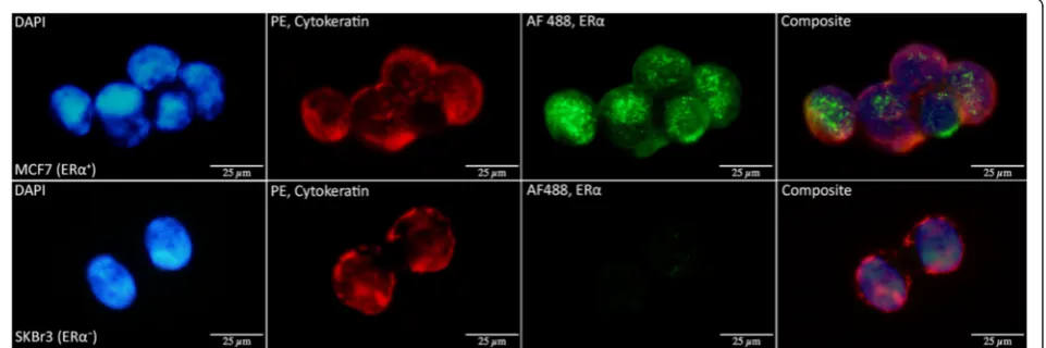 Figure 3 ERα staining of MCF7 and SKBr3 cells. Selective ERα staining demonstrated in MCF7 (ERα+) and SKBr3 (ERα−) cells