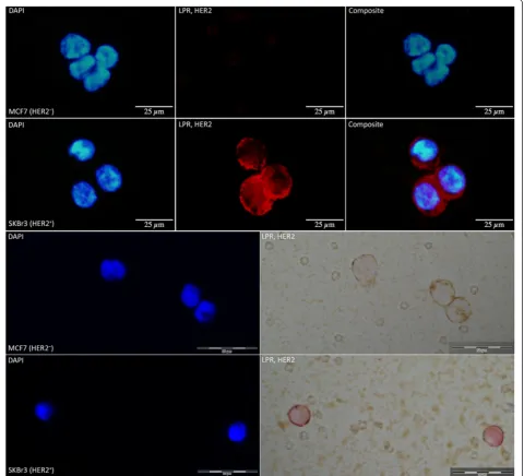 Figure 4 HER2-staining of MCF7 and SKBr3. Selective HER2 staining demonstrated in MCF7 (HER2−) and SKBr3 (HER2+) cells