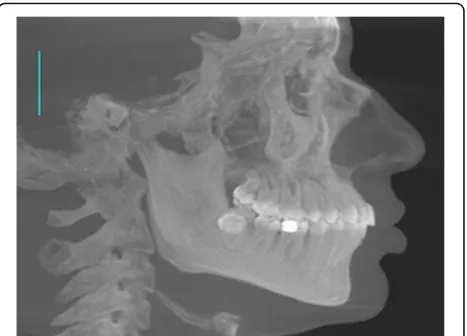 Fig. 1 CBCT-synthesized lateral cephalometric radiograph