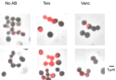 FIG 5 Teixobactin treatment causes Atl delocalization. In vitro binding of amidase repeats (Cy3-R 1–3 ) with the cell treated with teixobactin
