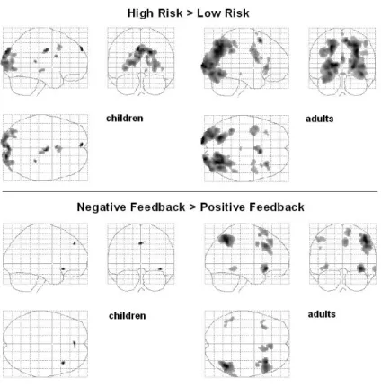 Figure  2.5  shows  the  glass  brain  images  for  both  comparisons,  and  Figure 2.6 shows an overlap of the two main comparisons: high-risk > 