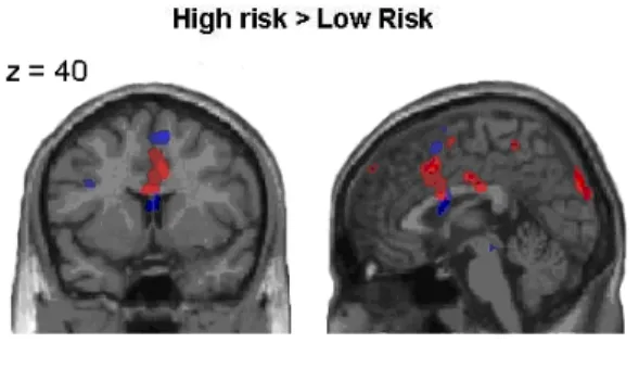 Figure 2.6 Neural correlates of risk estimation (high-risk  followed by  positive  feedback  >  low-risk  followed  by  positive  feedback),  and  negative  feedback  processing (high-risk followed by loss > high-risk followed by gain) in children  a