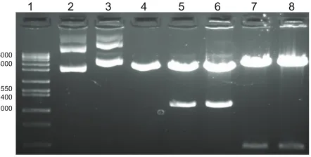 Figure 1 Agarose gel electrophoresis analysis of DMOMP. Notes: Molecular weight (1 kb) marker (lane 1), native phCMV1 vector (lane 2), native phCMV1 MOMP (lane 3), phCMV1 vector (4239 bp) restricted BamH 1 and Not 1 (lane 4), phCMV1 MOMP positive clones (4212 bp and 1134 bp) restricted BamH 1 and Not 1 (lanes 5 and 6) and phCMV1 MOMP clones (lanes 7 and 8) restricted Pst 1 (4823 bp and 531 bp).