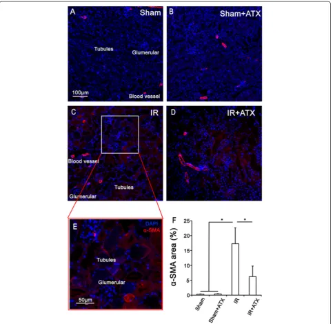 Figure 6 Effects of ATX on reduces the expression ofstaining oftissues. α-SMA in tubular cells after IR