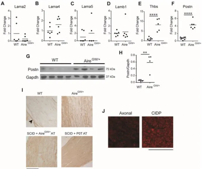 Figure 3. 1: Increased Postn expression in SAPP. A-F) RNA was isolated from the  sciatic nerves of NOD.WT (WT) and NOD.Aire GW/+  neuropathic mice
